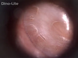 Dino-Lite Digital Microscope / Otoscope - AM4113-EUT