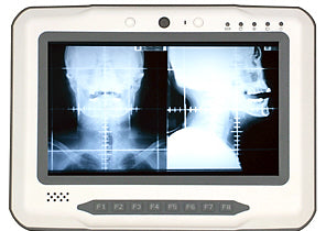Arbor 7" Intel® Atom™ Z510 Mobile Medical Data Terminal G0710